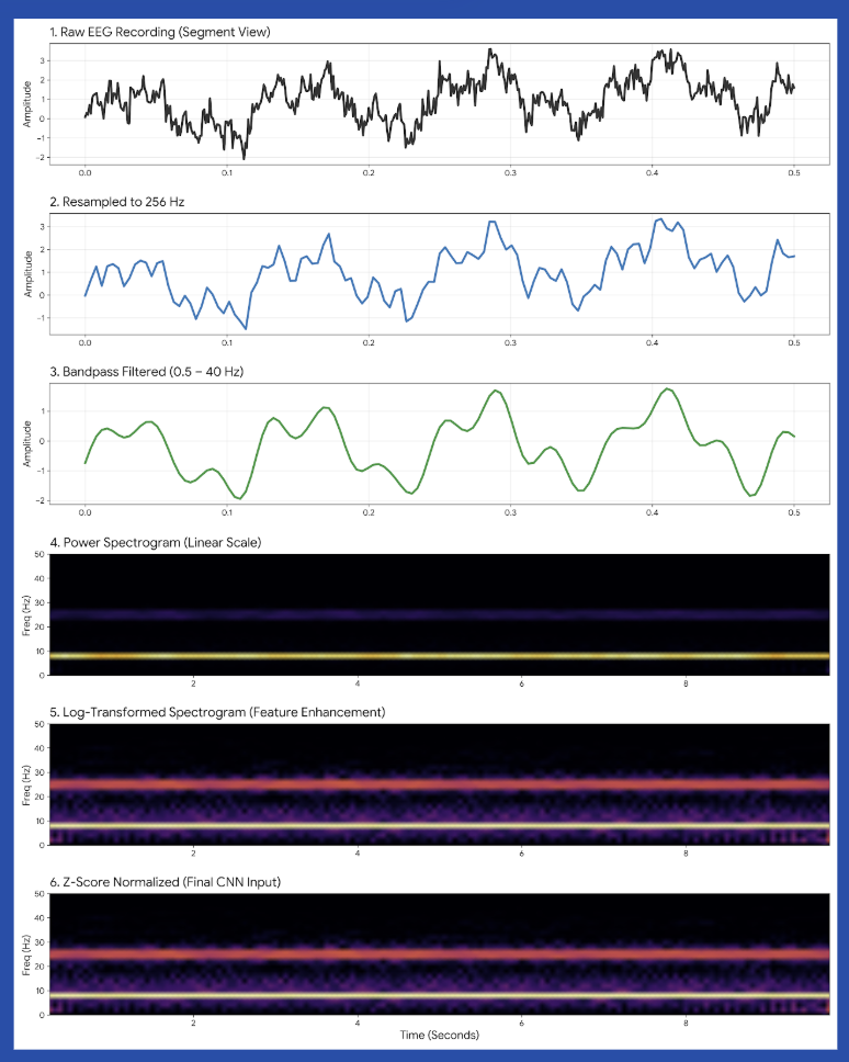 Six-panel EEG preprocessing pipeline: raw EEG recording segment, resampled to 256 Hz, bandpass filtered 0.5 to 40 Hz, power spectrogram on a linear scale, log-transformed spectrogram for feature enhancement, and z-score normalized final CNN input