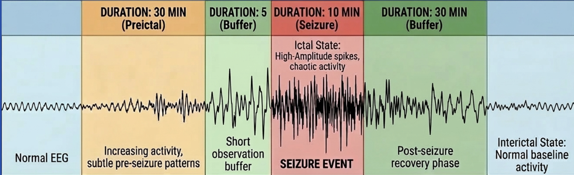 EEG timeline showing seizure phases: normal EEG, 30-minute preictal state with subtle pre-seizure patterns, 5-minute buffer, 10-minute ictal seizure event with high-amplitude chaotic spikes, 30-minute post-seizure recovery buffer, and interictal baseline